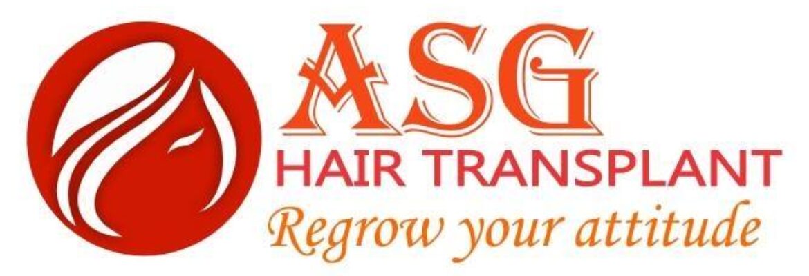 ASG Hair Transplant Centre | Hair Transplant in Punjab